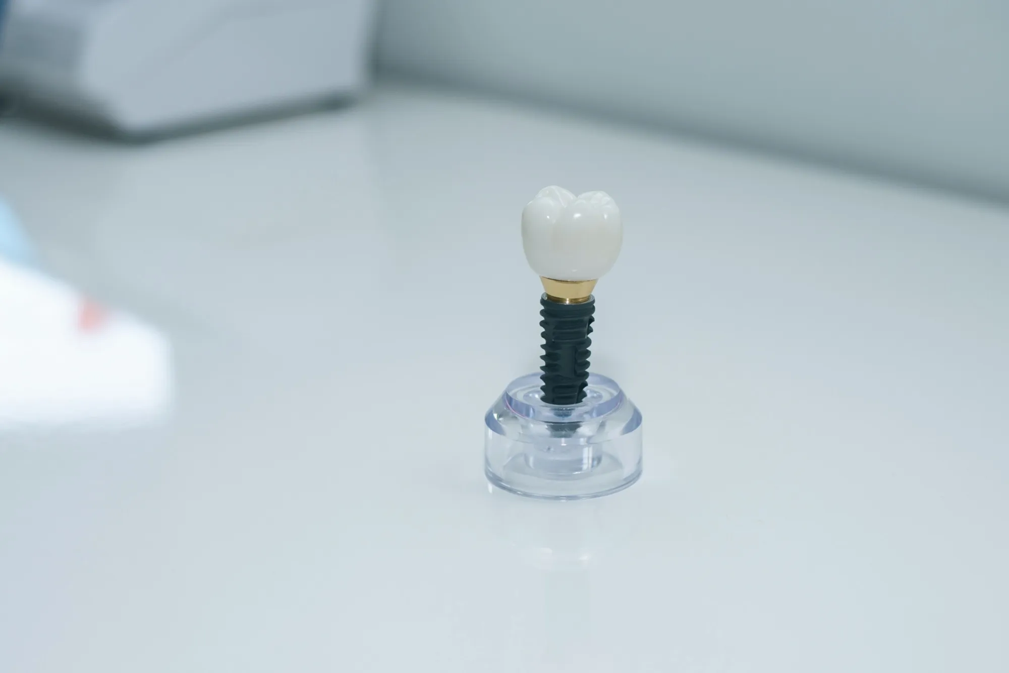 implantat-tann